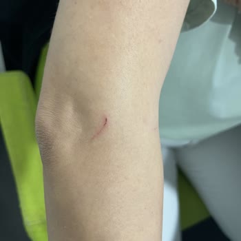 Çalışanın Dikkatsizliği Sonucu Yaralanma Ve İlgisiz Mağaza Personeli