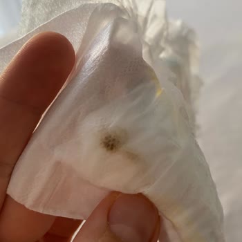 Bebek Bezi Paketinde Sertlik Ve Lekeler: Hayal Kırıklığına Uğradım