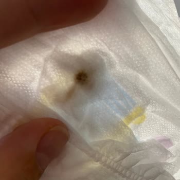 Bebek Bezi Paketinde Sertlik Ve Lekeler: Hayal Kırıklığına Uğradım