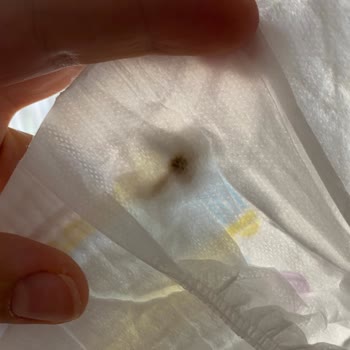 Bebek Bezi Paketinde Sertlik Ve Lekeler: Hayal Kırıklığına Uğradım