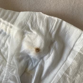 Bebek Bezi Paketinde Sertlik Ve Lekeler: Hayal Kırıklığına Uğradım