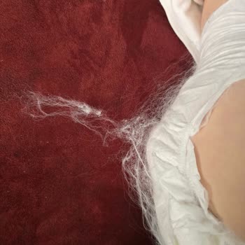 Bebek Bezinde Tülerme Sorunu Ve Yetersiz Firma Yaklaşımı