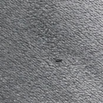 Koltuk Takımında Erken Deformasyon Ve Hatalı Servis Değerlendirmesi