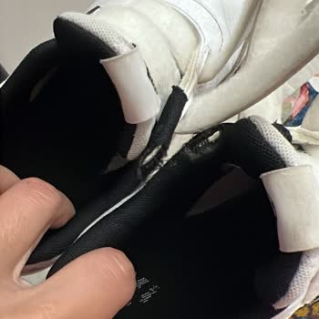 1,5 Ayda Sökülen Adidas Ayakkabıya Red Cevabı Ve Hayal Kırıklığı