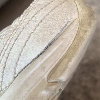 Skechers Ayakkabım Yırtıldı, Marka Sorumluluk Almıyor!