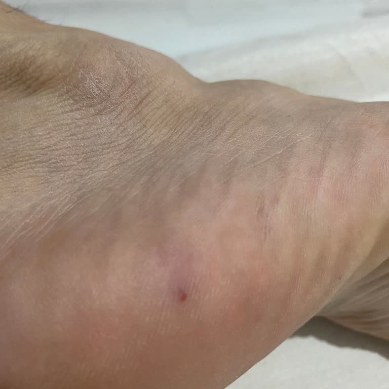 Mağazada Ayakkabı Denerken Alarm Çivisi Ayağımı Yaraladı