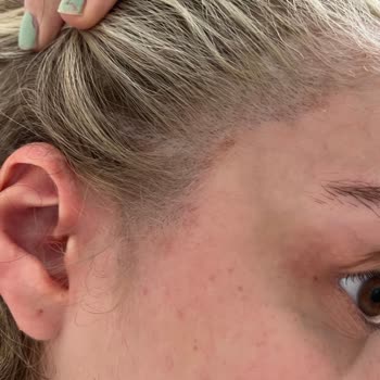 Panora Hair Salon Rize Rengi Görselleriyle Belirtmeme Rağmen Yanlış İşlem Yaptı