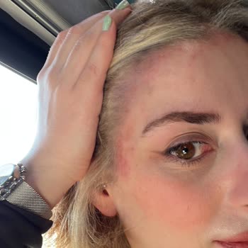 Panora Hair Salon Rize Rengi Görselleriyle Belirtmeme Rağmen Yanlış İşlem Yaptı