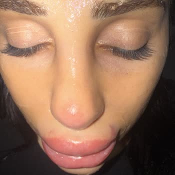 Beklentilerimi Karşılamayan Hizmet Ve İletişim Sorunları