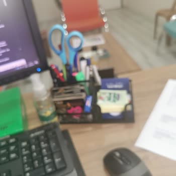 I Can’t Fix My Huawei P30 Pro Camera That Shakes and Blurs