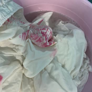 Yves Rocher Sunscreen Stained and Discolored My Clothes