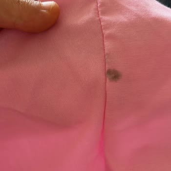 Geç Gelen Ve Lekeli Ürün, İletişimde Büyük Aksaklık Yaşadım