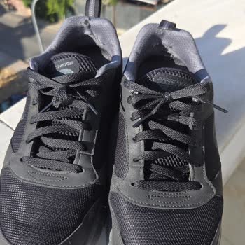 Aldığım Ayakkabılarda Tekrarlayan Topuk Deformasyonu Sorunu