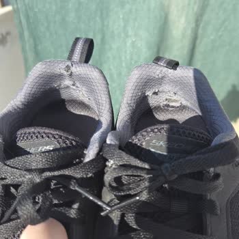 Aldığım Ayakkabılarda Tekrarlayan Topuk Deformasyonu Sorunu