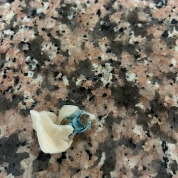 Dondurulmuş Mantıdan Çıkan Yabancı Madde Ve Müşteri Hizmetleri Sorunu