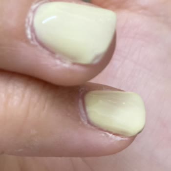 Tırnak Güçlendirme Hizmeti Beklentilerimi Karşılamadı