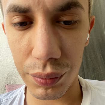 Burun Estetiği Sonrası Nefes Alma Ve Güven Kaybı Yaşadım