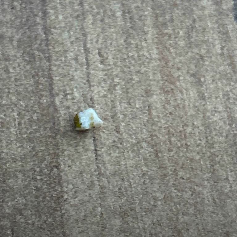 Sipariş Verdiğim Pestilin İçinden Taş Çıktı, Dişim Kırıldı