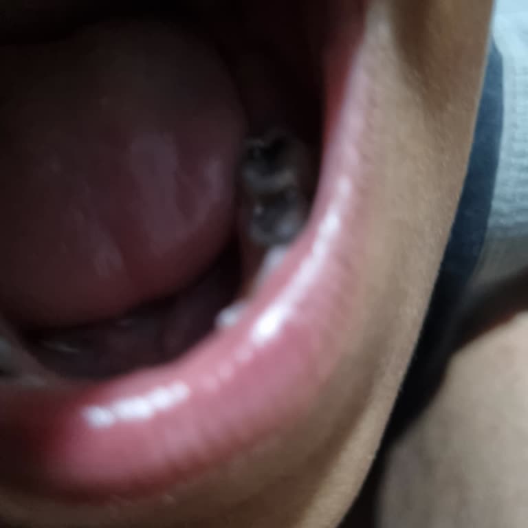 Alanya Adsm Çocuğumun Diş Ağrısına İlgisiz Yaklaşım Ve Yetersiz Tedavi