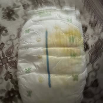 Hatalı Ve Sert Bebek Bezi Nedeniyle Memnuniyetsizlik