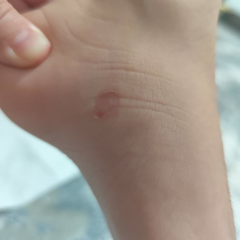 Aldığım Paten Ayağı Yaraladı, İade Talebim Reddedildi