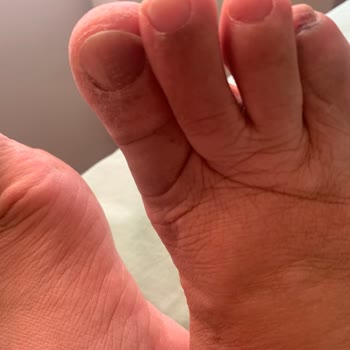 Lumberjack Ayakkabı Sağlık Sorunu Ve İade Reddi