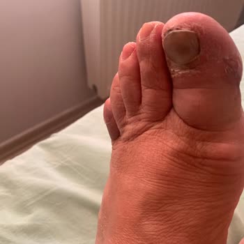 Lumberjack Ayakkabı Sağlık Sorunu Ve İade Reddi