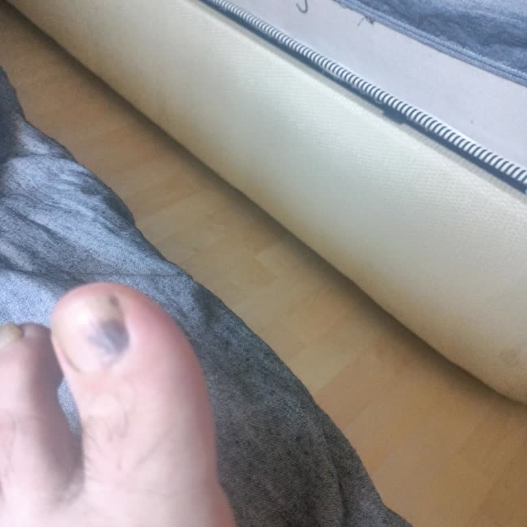 Aldığım Nike Ayakkabı Ayağımı Yaraladı, Mağaza Sorumluluk Almadı