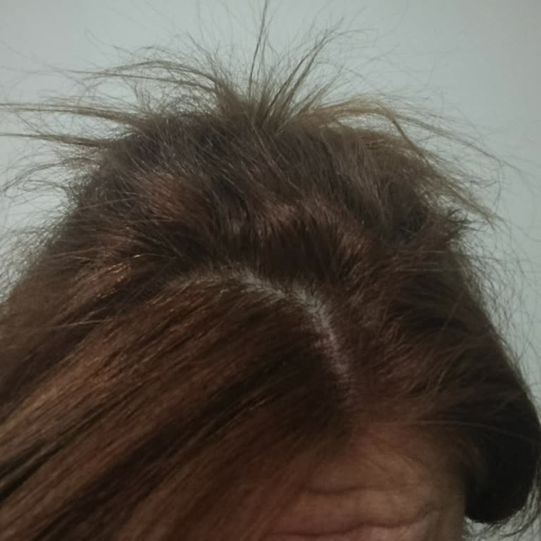 Saç Boyası Renk Sonucunun Beklenenden Farklı Olması Ve Memnuniyetsizlik