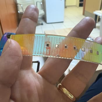 Welder Saatimin Kordonu 2 Ayda Kırıldı, Garanti Sürecinde Mağdur Oldum