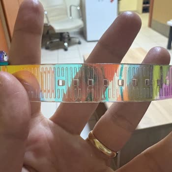 Welder Saatimin Kordonu 2 Ayda Kırıldı, Garanti Sürecinde Mağdur Oldum