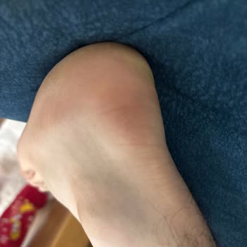 Aldığım Spor Ayakkabı İlk Giyimde Yırtıldı, Değişim Talebim Reddedildi