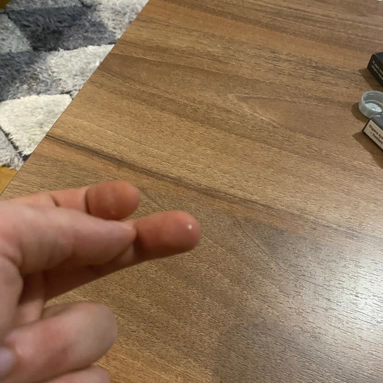 Satın Aldığım Uludağ Gazoz Şişelerinden Cam Parçası Çıkması Ve Yaralanma