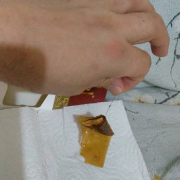 Üründe Kıla Benzer Yabancı Madde Şoku: Sağlığımız Tehlikede!