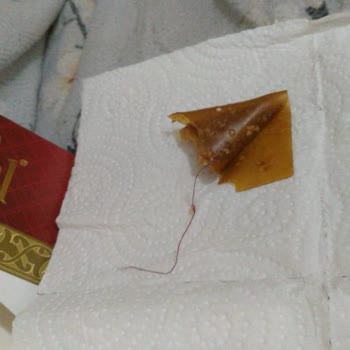 Üründe Kıla Benzer Yabancı Madde Şoku: Sağlığımız Tehlikede!