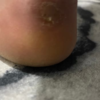 Aldığım Ayakkabı Ayağımı Yaraladı, İnceleme Sonucu Yetersiz Kaldı