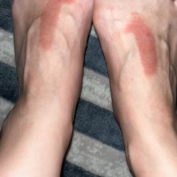 Deneme Sonrası Dezenfekte Edilmeyen Ayakkabılar Sağlık Sorununa Yol Açtı