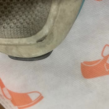 Kısa Sürede Açılan Ayakkabıya Çözüm Bekliyorum!