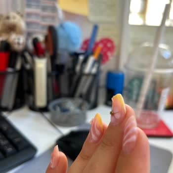 Tırnak Hizmetinde Yaşanan Memnuniyetsizlik Ve İletişim Sorunları