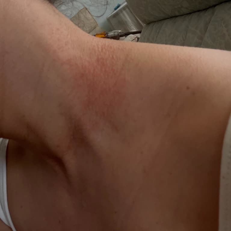 Flu Aksesuar Geç Gelen Sipariş, Eksik Ürün Ve Alerjik Reaksiyon Şikayeti