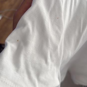 Vestel Çamaşır Makinesinde Tekrarlayan Arıza Ve Yetersiz Destek