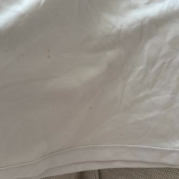 Vestel Çamaşır Makinesinde Tekrarlayan Arıza Ve Yetersiz Destek