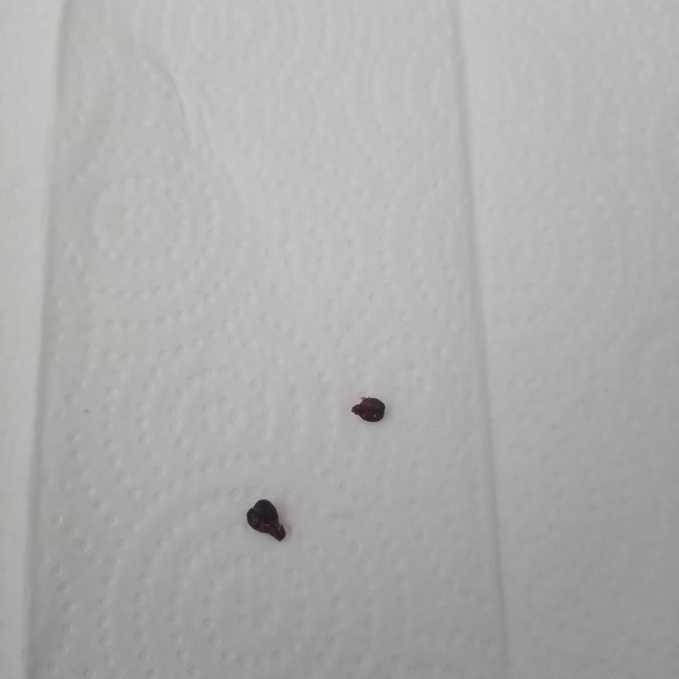 Burcu Gıda Zeytinyağlı Yaprak Sarmasında Yabancı Cisim Ve Düşen Kalite