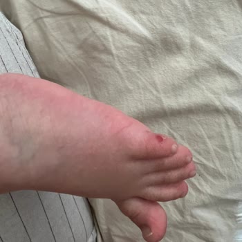 Aldığım İgor Sandalet Bebeğimin Ayağını Yaraladı, Mağduriyetimin Giderilmesini İstiyorum