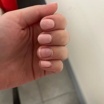 Kalıcı Oje Ve Jel Uygulaması 10 Günde Soyulup Kırıldı, Bakım Reddedildi