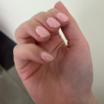 Kalıcı Oje Ve Jel Uygulaması 10 Günde Soyulup Kırıldı, Bakım Reddedildi