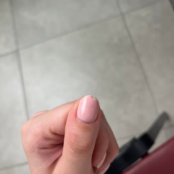 Kalıcı Oje Ve Jel Uygulaması 10 Günde Soyulup Kırıldı, Bakım Reddedildi