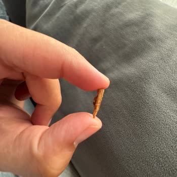 Altınmarka Çikolatanın İçinden Çıkan Tahta Parçası İle Yaşadığım Tehlike