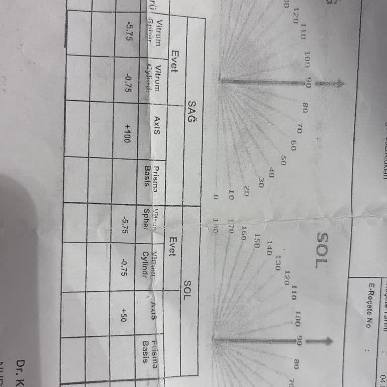 Yanlış Bilgilendirme Nedeniyle Gözlük İadesinde Mağduriyet Yaşadım