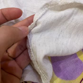 Satın Aldığım Gömlekteki Kusurlar Ve Yetersiz Müşteri Desteği